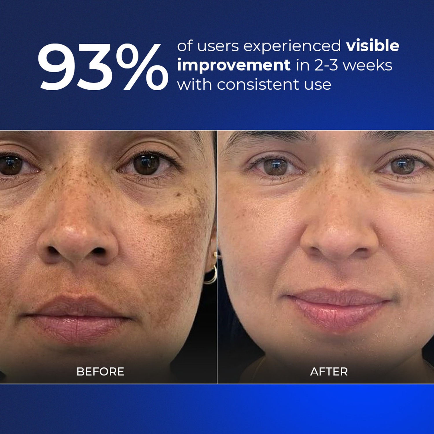 Image of Aqueria Sunscreen - SPF 50 PA++++ Brightening & Hydrating French Multi-Active SPF | Niacinamide, Tranexamic Acid