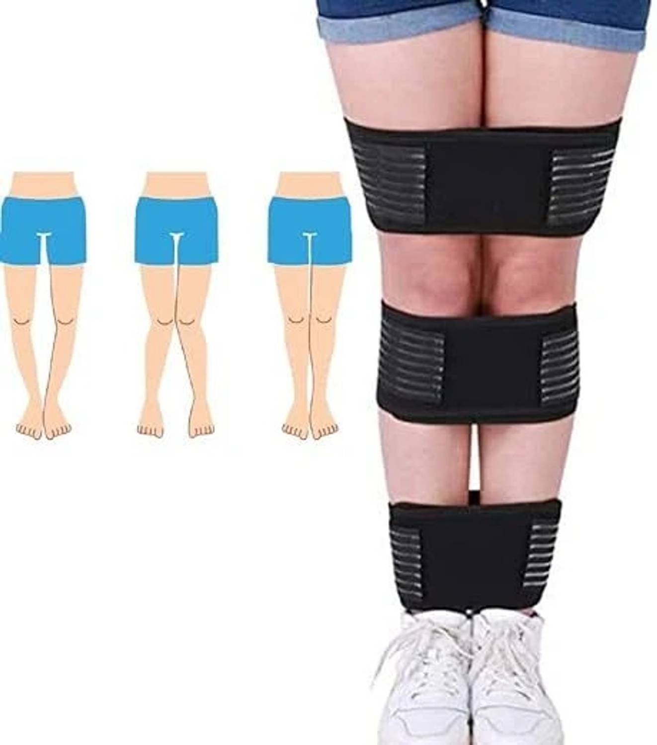 Litenyx Bow Leg Correction Belt Men and Women O/X Type Knee Calf & Thigh Support(XXL) Knee Support