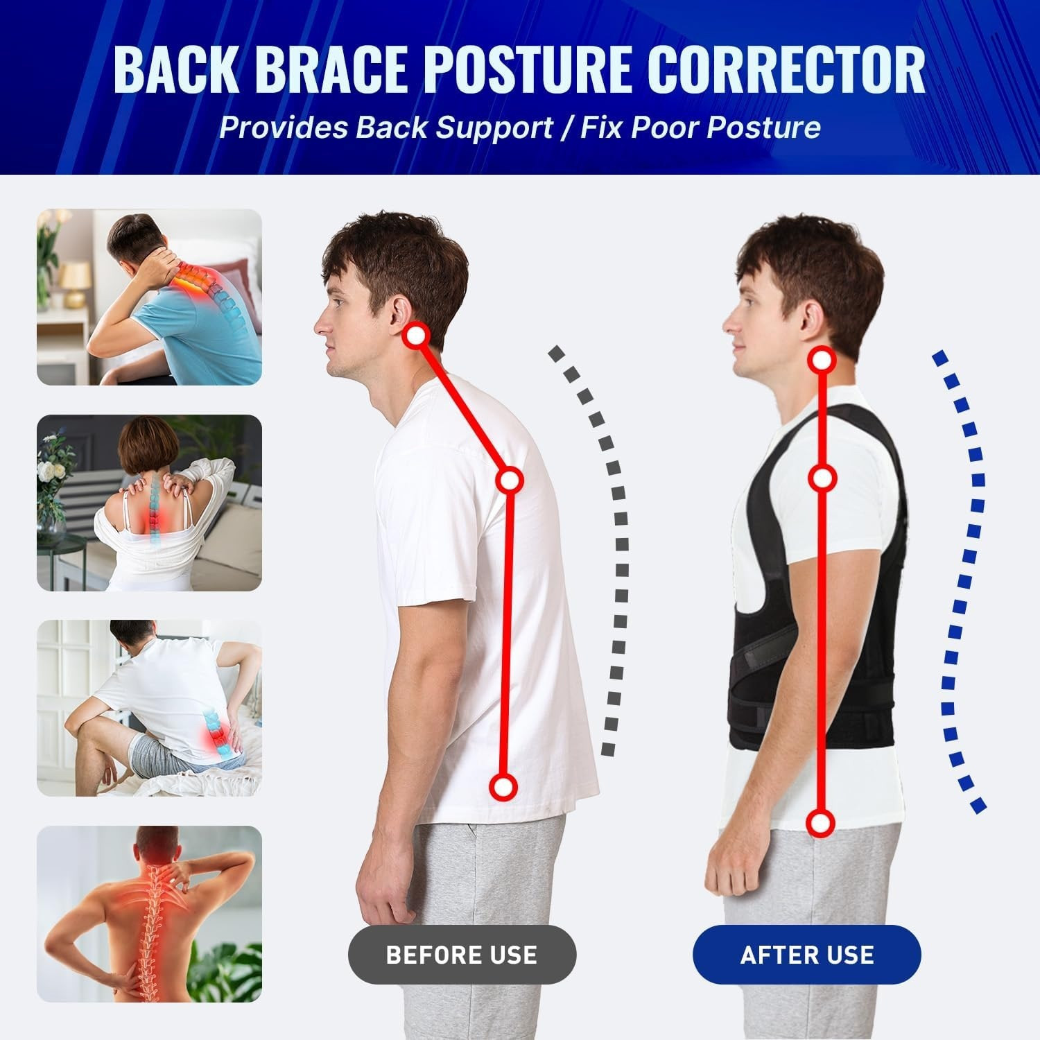 Image of TENACT Premium Shoulder Alignment Posture Corrector Belt for Men & Women Comfort Posture Corrector