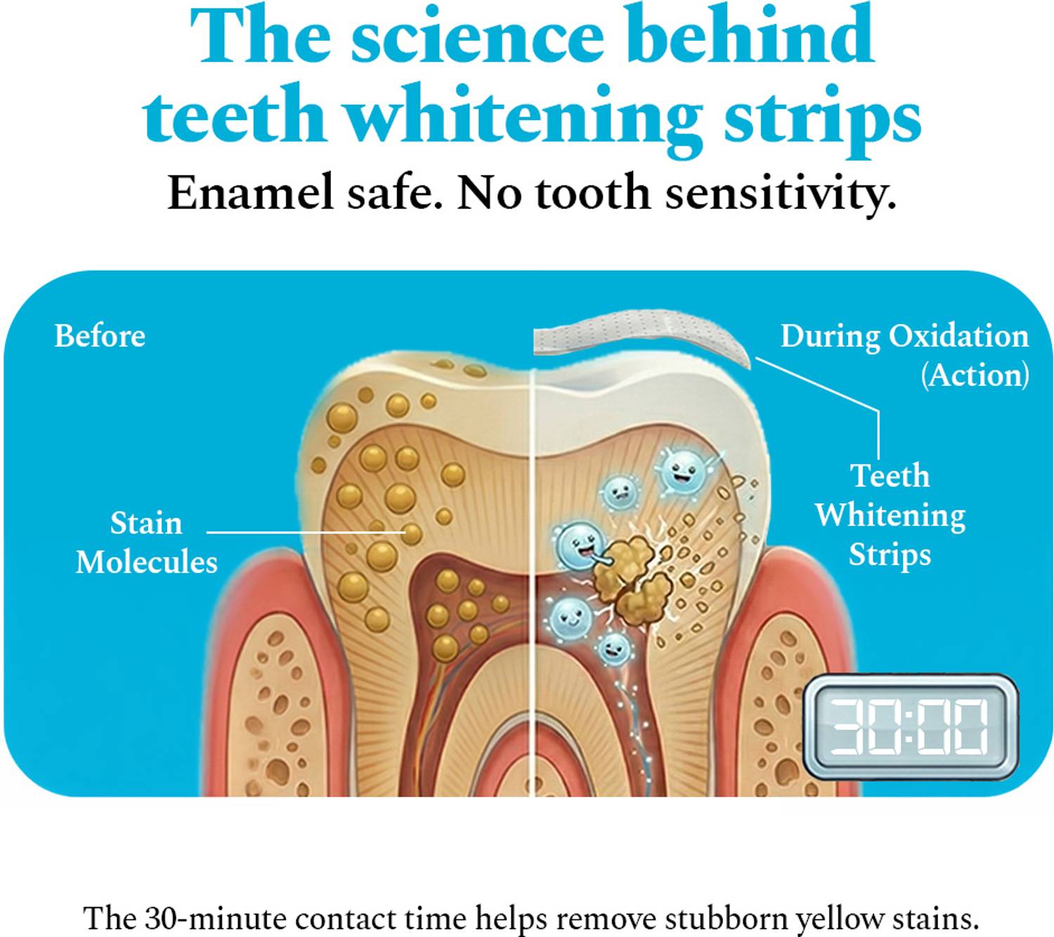 Perfora Teeth Whitening Strips 14 Treatments - Image 3