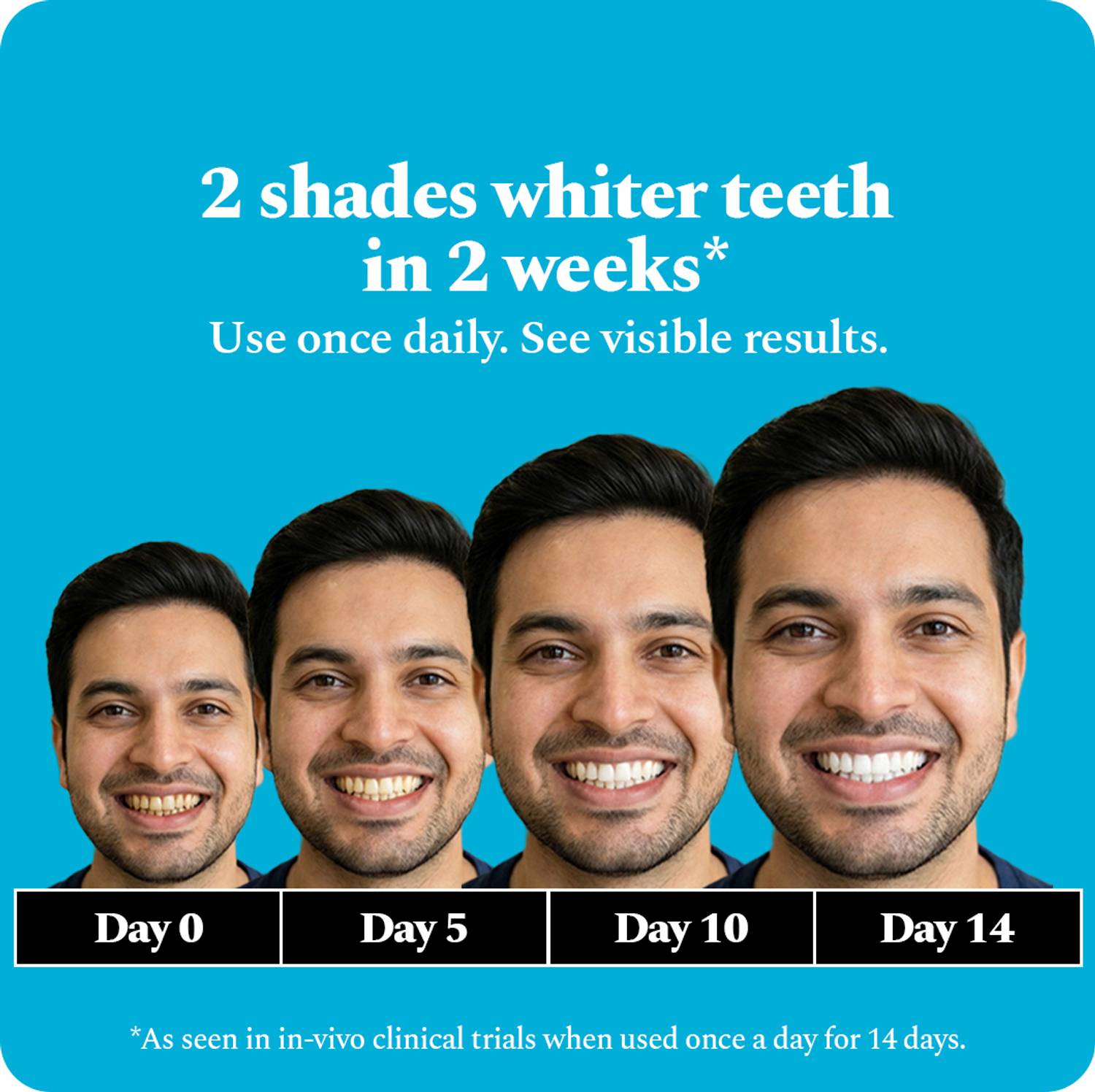 Perfora Teeth Whitening Strips 14 Treatments - Image 2