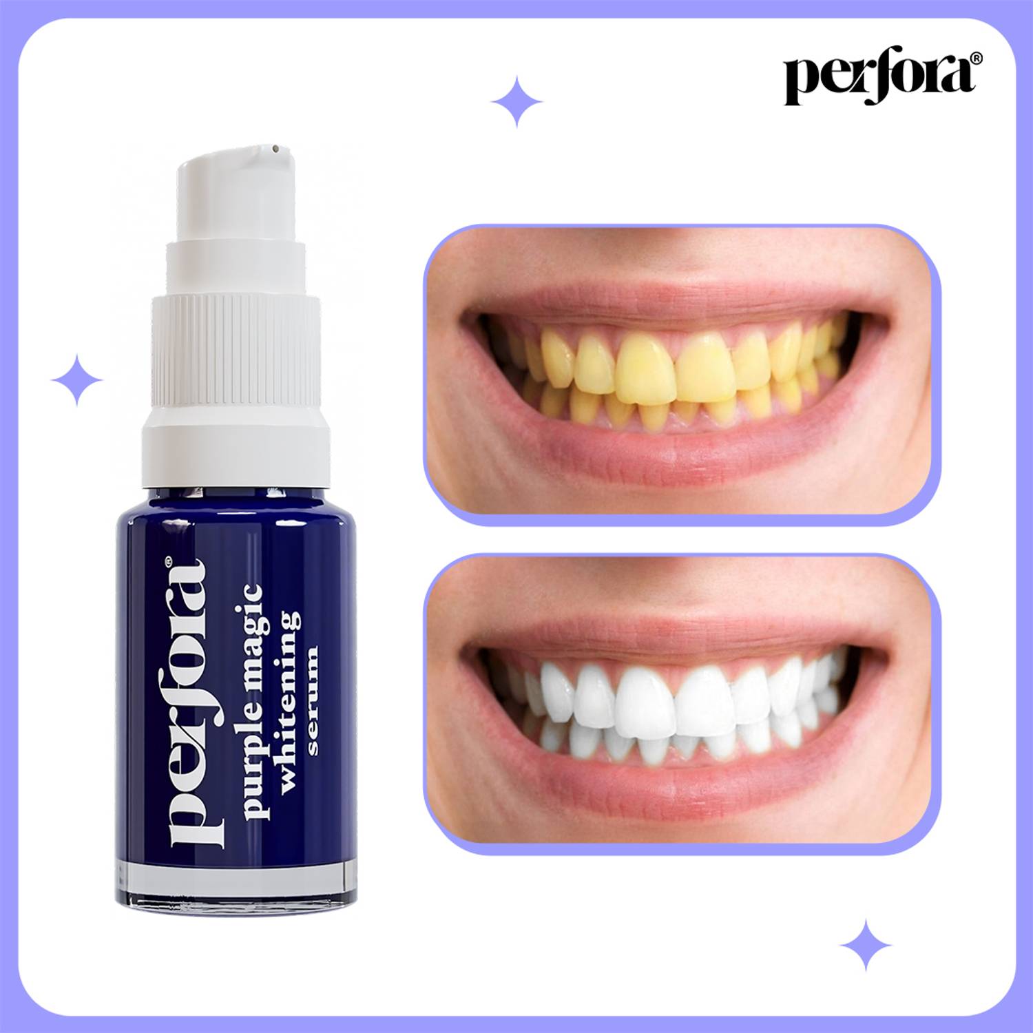 Perfora Purple Teeth Whitening Toothpaste Serum 10ml - Image 1