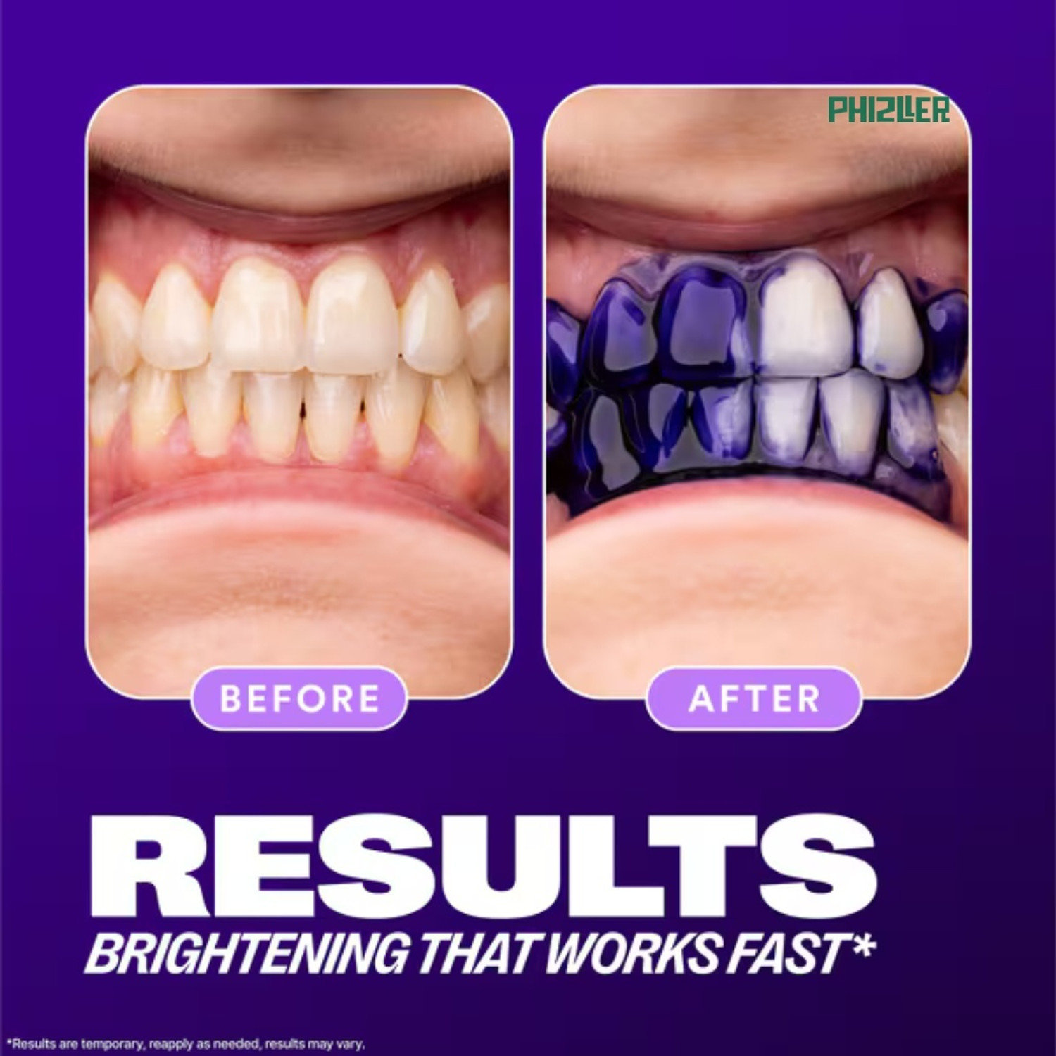 Image of phizller hismile V34 Tooth Brightening Color Gel for Instant Whitening Look Teeth Whitening liquid
