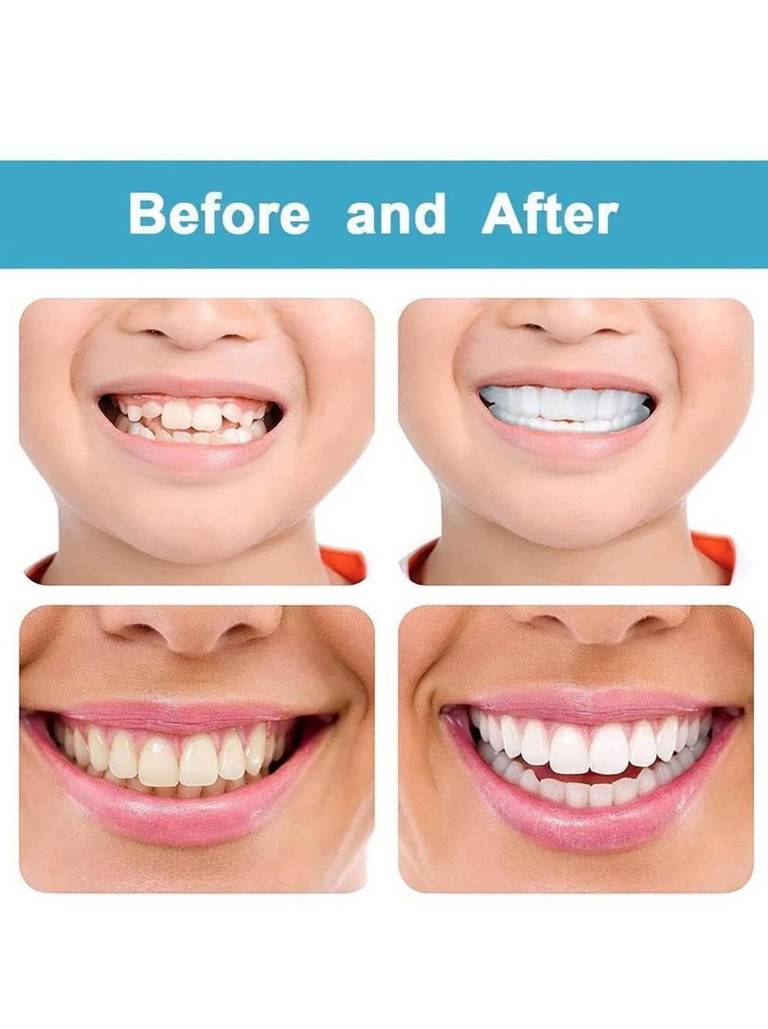 Buyerzone Comfort Fit Teeth Whitening Veneers Instant Perfect Smile Teeth Wipe