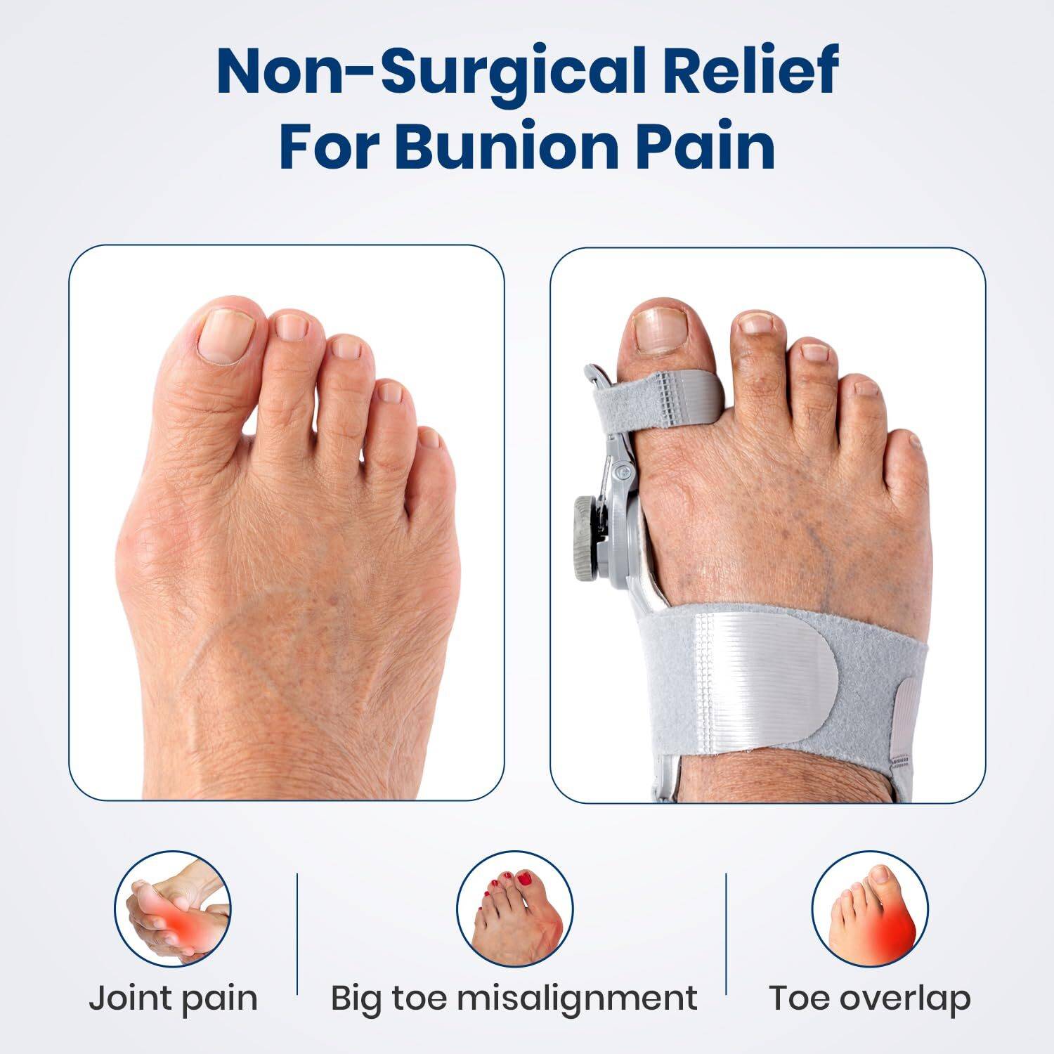 AGEasy Orthopedic Toe Straightener, Adjustable Bunion Corrector - Image 4