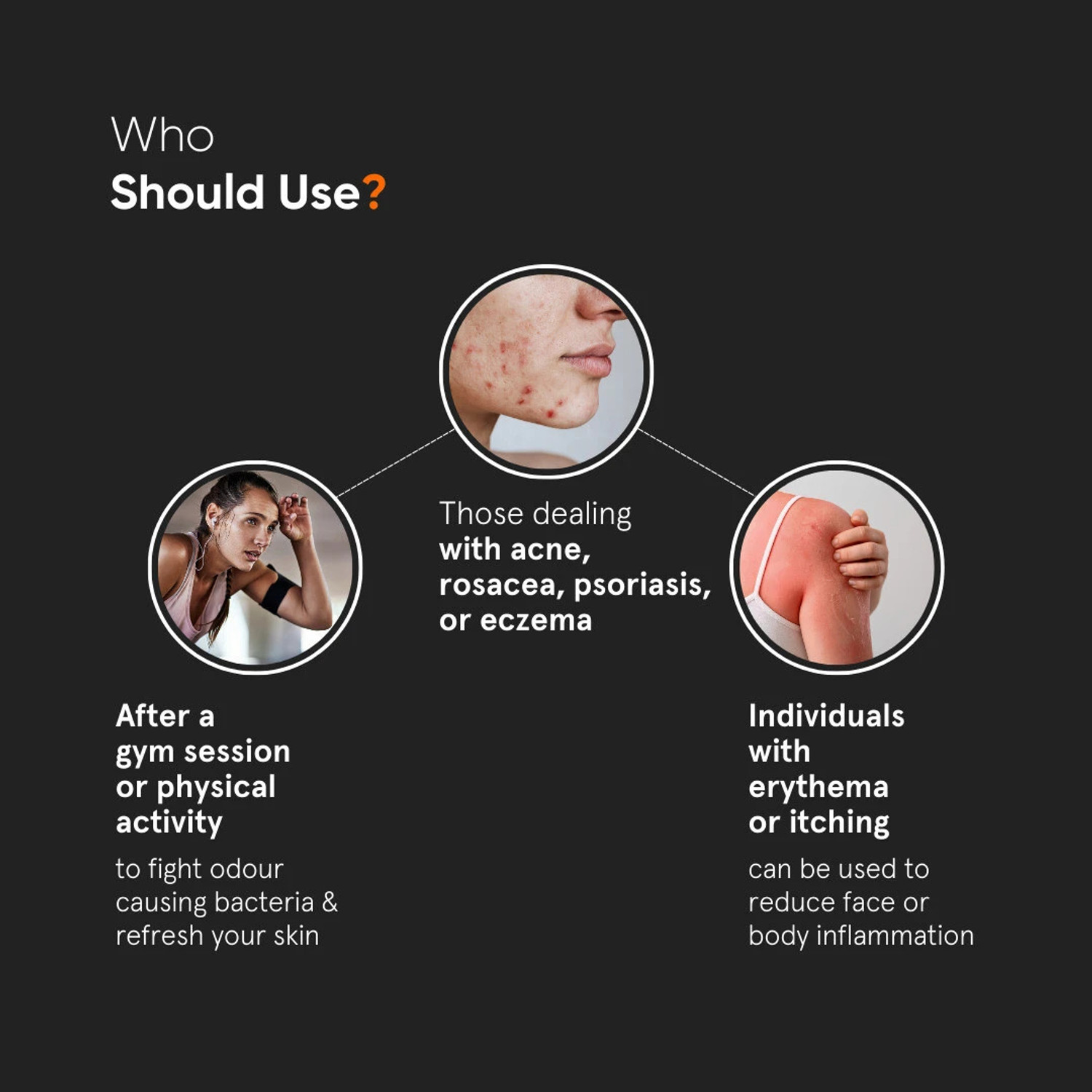 Image of Minimalist HOCl Skin Relief Spray|Relief on Eczema,Redness|Anti-microbial Anti inflammatory Men & Women