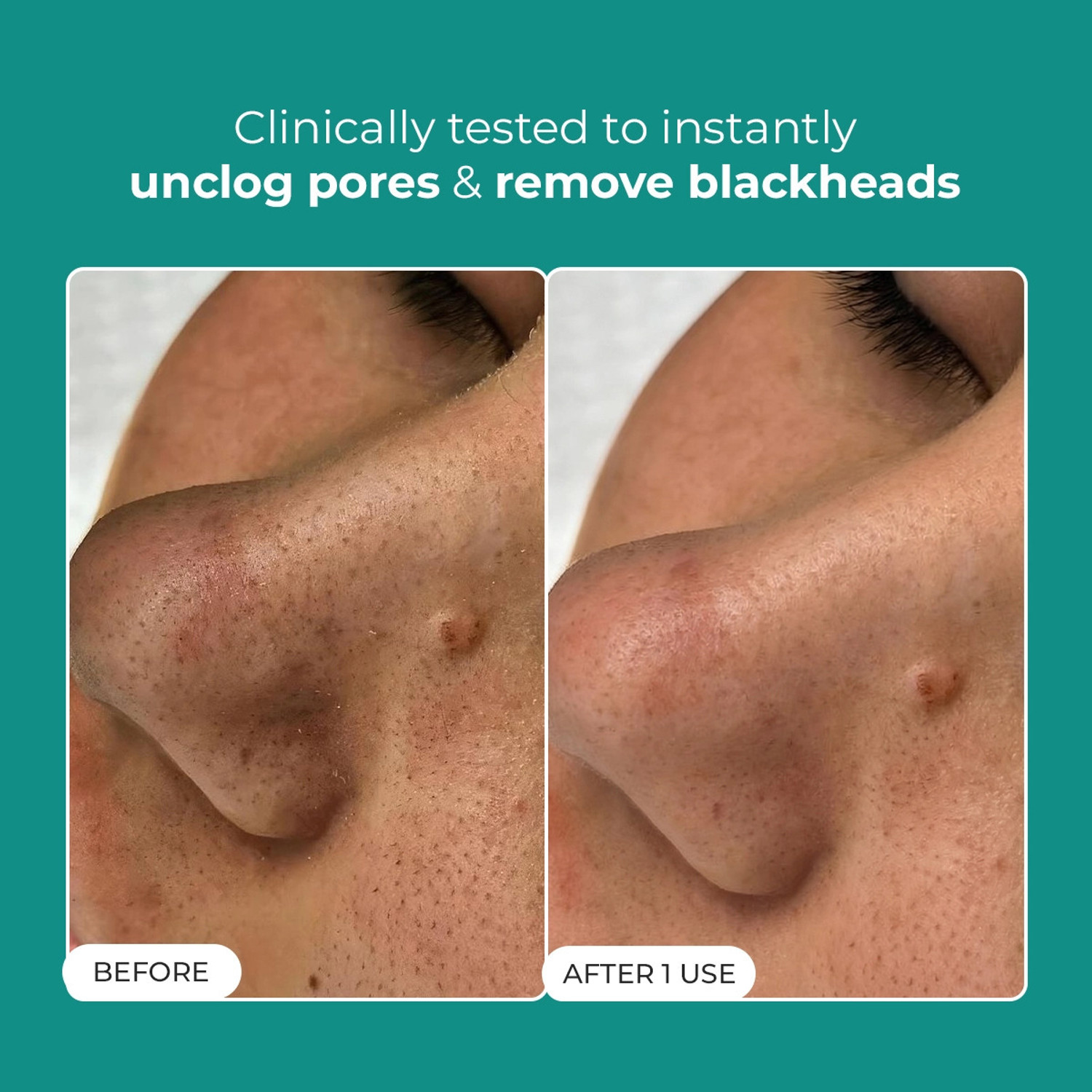 Image of Conscious Chemist Blackhead Melting Water | Succinic, Glycolic Acid & CICA Exosome. Smooth Pores Men & Women