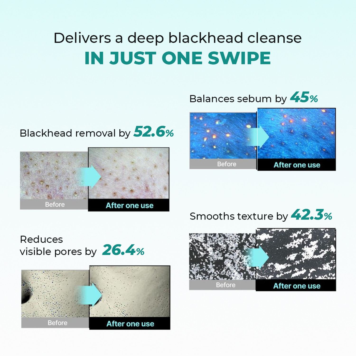Image of Conscious Chemist Blackhead Melting Water | Succinic, Glycolic Acid & CICA Exosome. Smooth Pores Men & Women