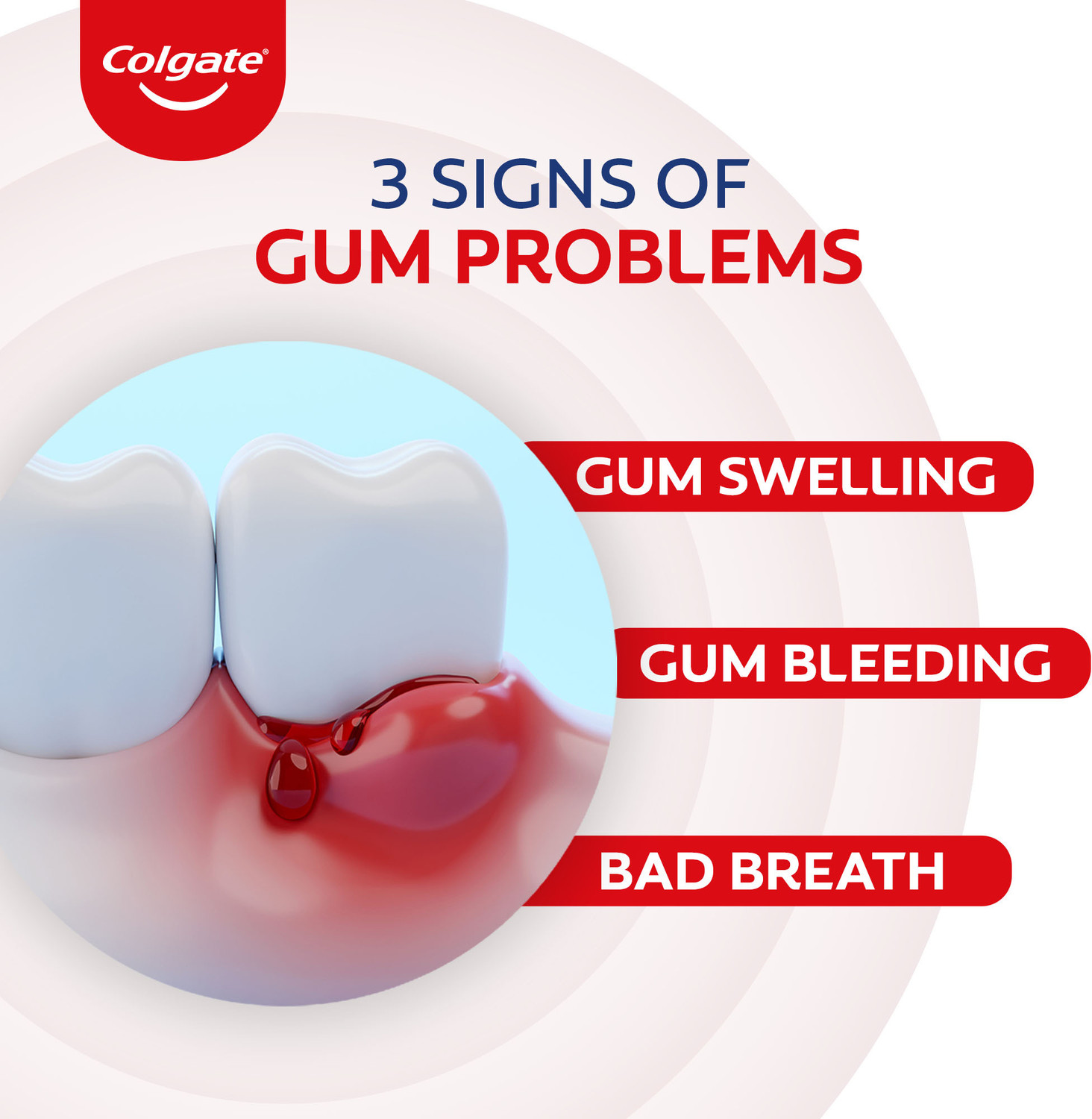 Image of Colgate PerioGard Tooth paste, Specialized Gum Care System, Gum Problems Toothpaste