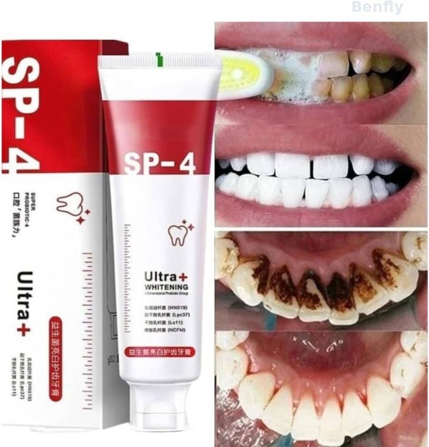 BENFLY SX Ultra Brightening Toothpaste Advanced Whitening Formula for Stain Removal Toothpaste