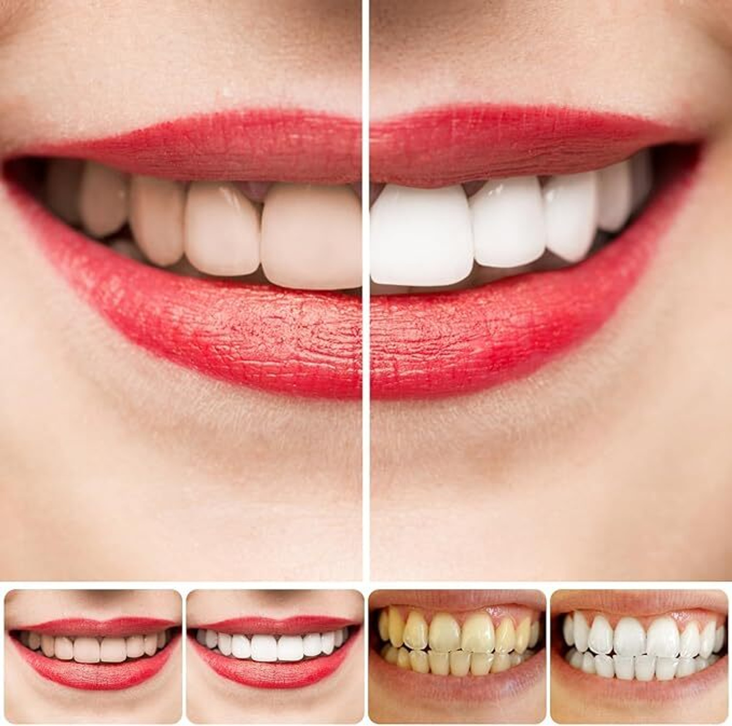 Image of Qynora Sp 4 Ultra Whitening Probiotic Toothpaste for men and women Toothpaste
