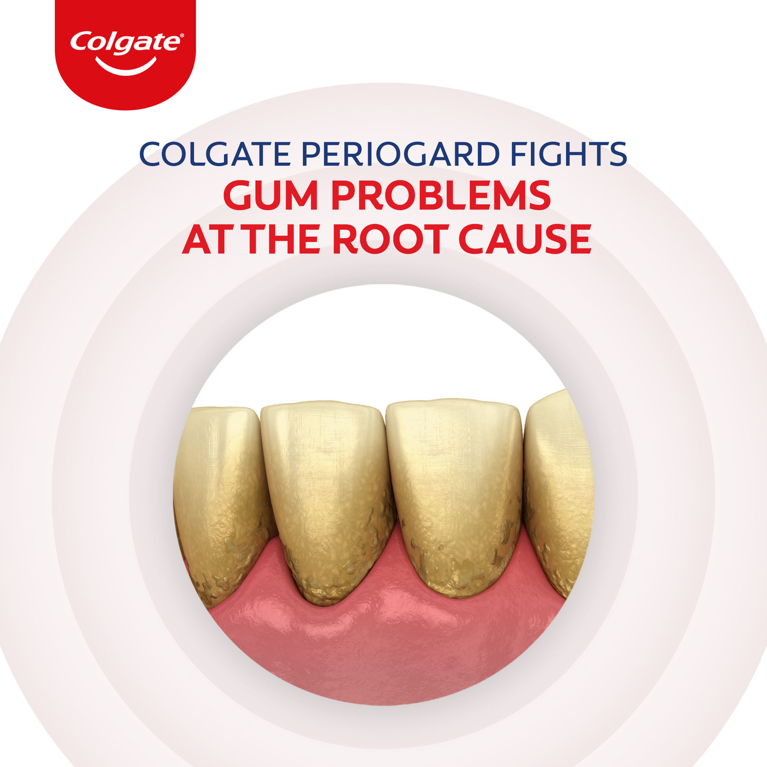 Image of Colgate PerioGard Tooth paste, Specialized Gum Care System, Gum Problems Toothpaste