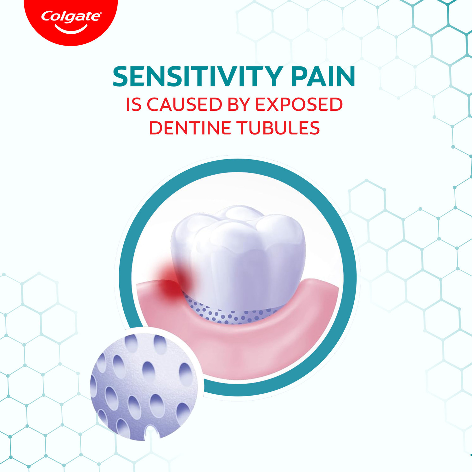Image of Colgate Sensitive Plus Toothpaste