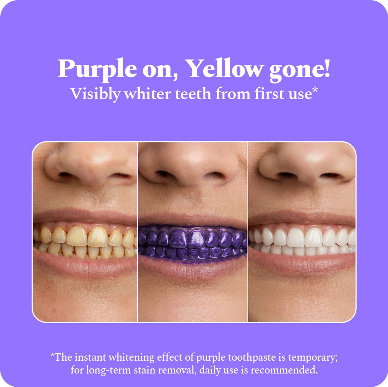 Perfora Purple Whitening Toothpaste - Image 2
