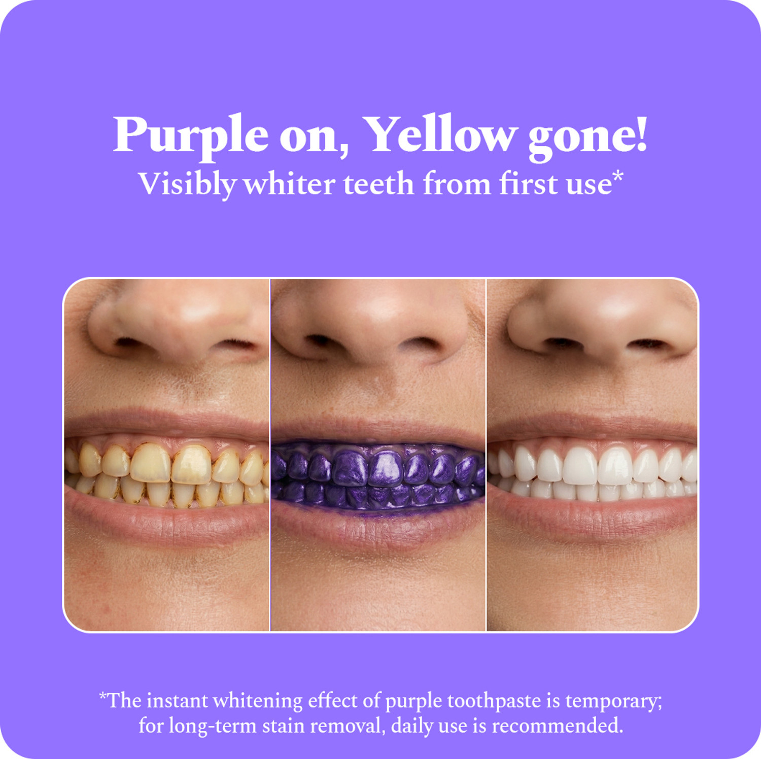 Image of Perfora Purple Whitening Toothpaste, Color Corrector Formula, SLS Free Toothpaste