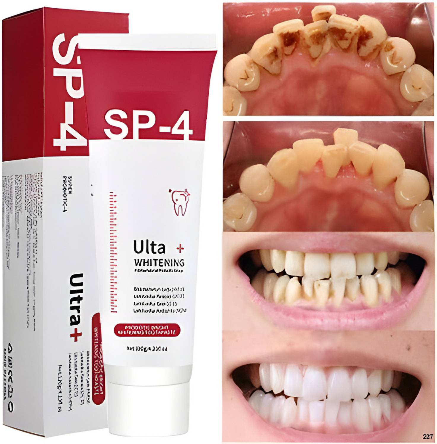 ERVY SP-4 Ultra Whitening Probiotic Toothpaste SP 4 Ultra Toothpa