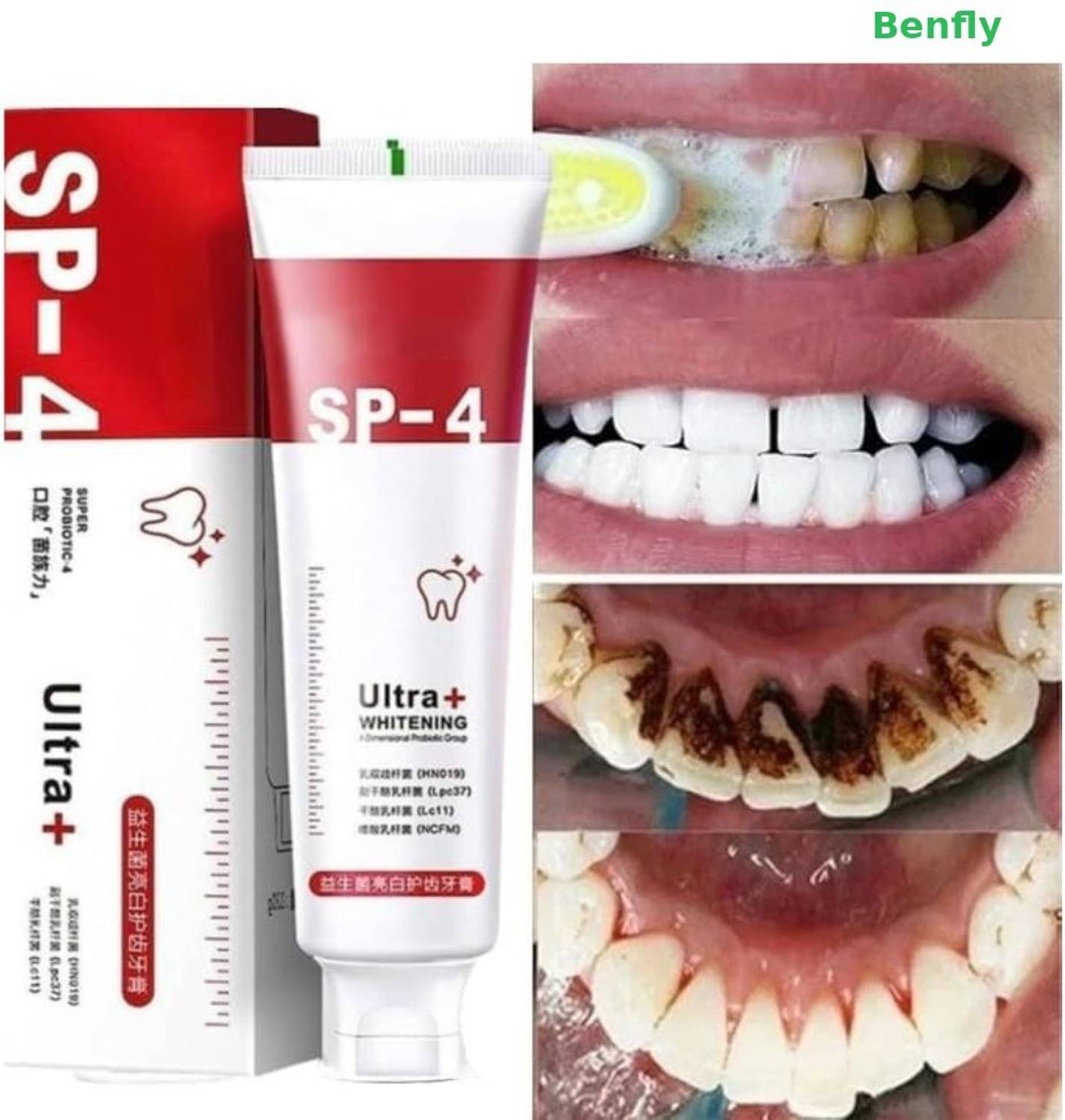 BENFLY TB Ultra Brightening Toothpaste Advanced Whitening Formula for Stain Removal Toothpaste