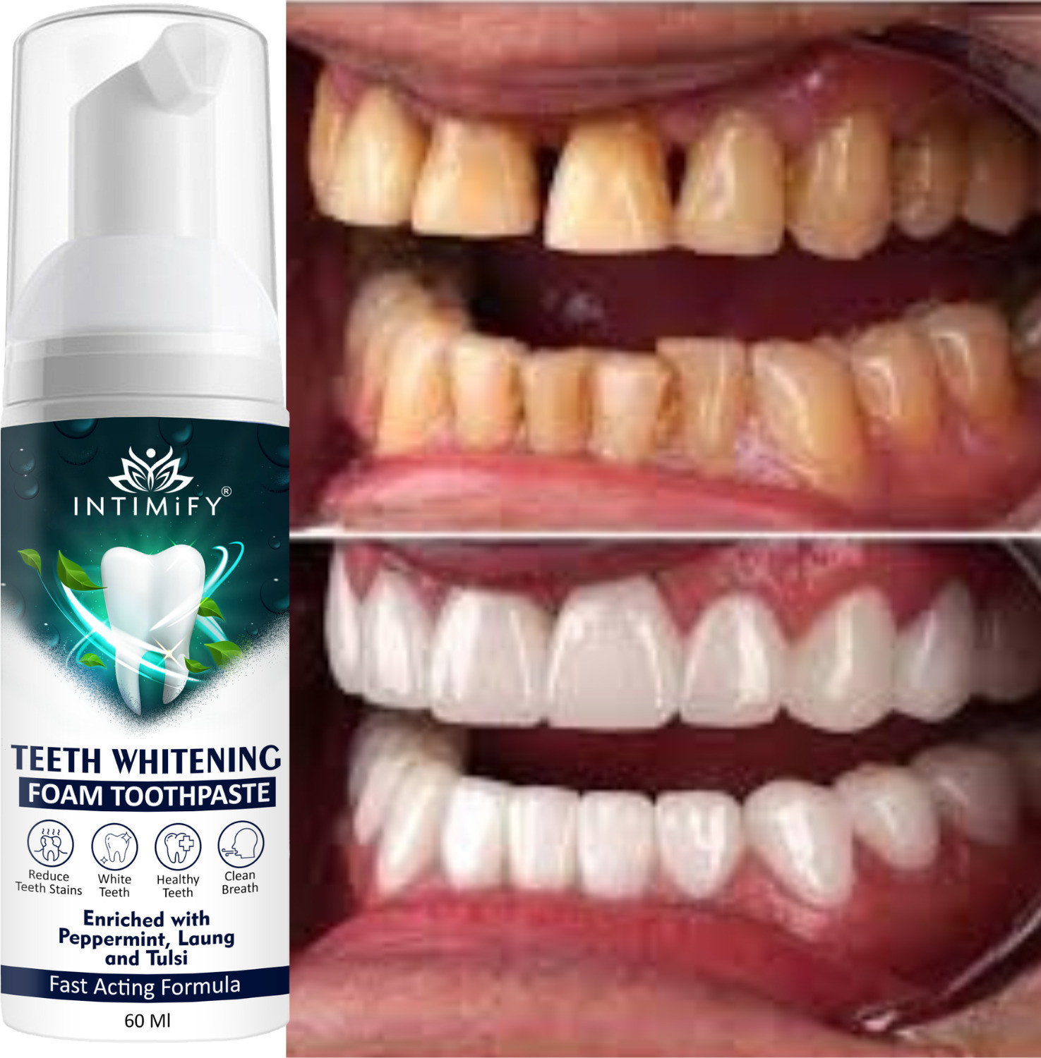 tobacco stain removing toothpaste Smoker's Toothpaste, Remove Organic Ingredients Breath Safe For Care For Whiten Your Teeth For Remove Stains Rocs Coffee & Tobacco Stain