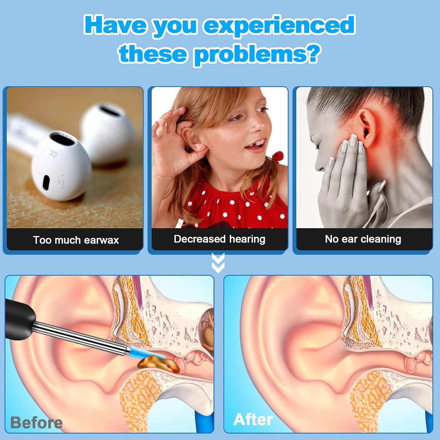 Image of Kripara Sales 1PCS Ear Wax Removal Kit with HD Camera Wifi Connection Reusable Endoscope Tool