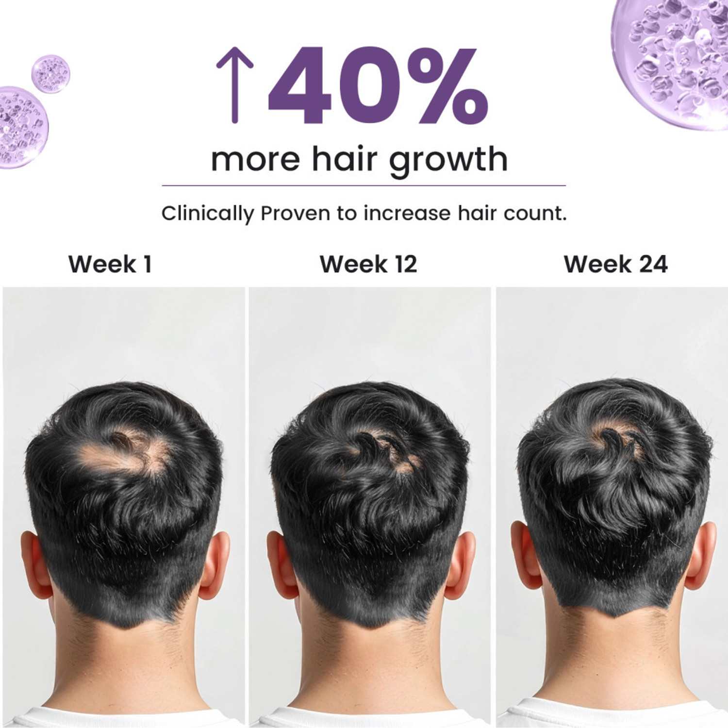 Image of Neuherbs Biotin for Hair Growth| DHT Blocker Supplement|Hair Fall Control & Damage Repair