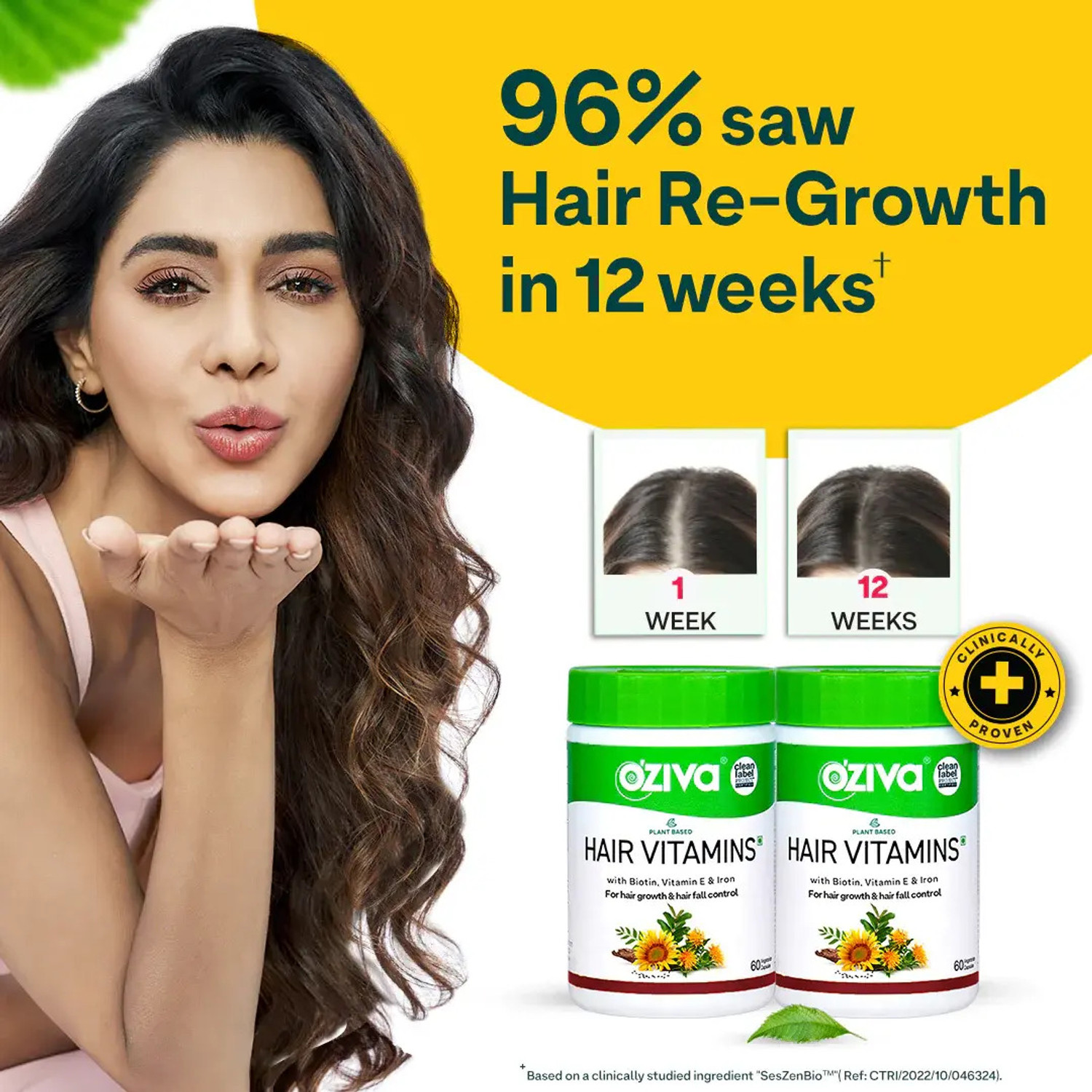 Image of OZiva Hair Vitamins (with Biotin & Iron)for Hair Regrowth & Hairfall Control
