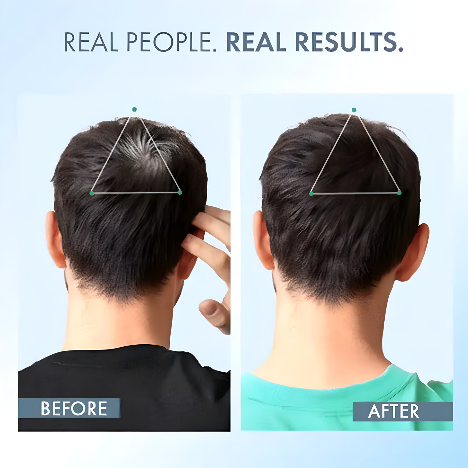 Image of ThriveCo Anti-Greying Supplement | Drug-Free | Delays Greying & Restores Melanin