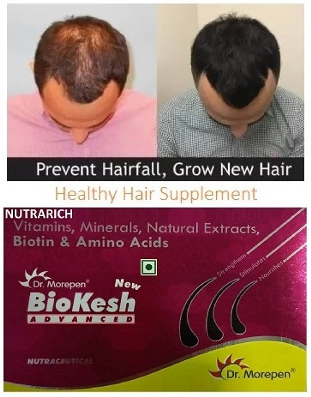 NUTRARICH Advanced Biotin for Hair Growth - Image 2
