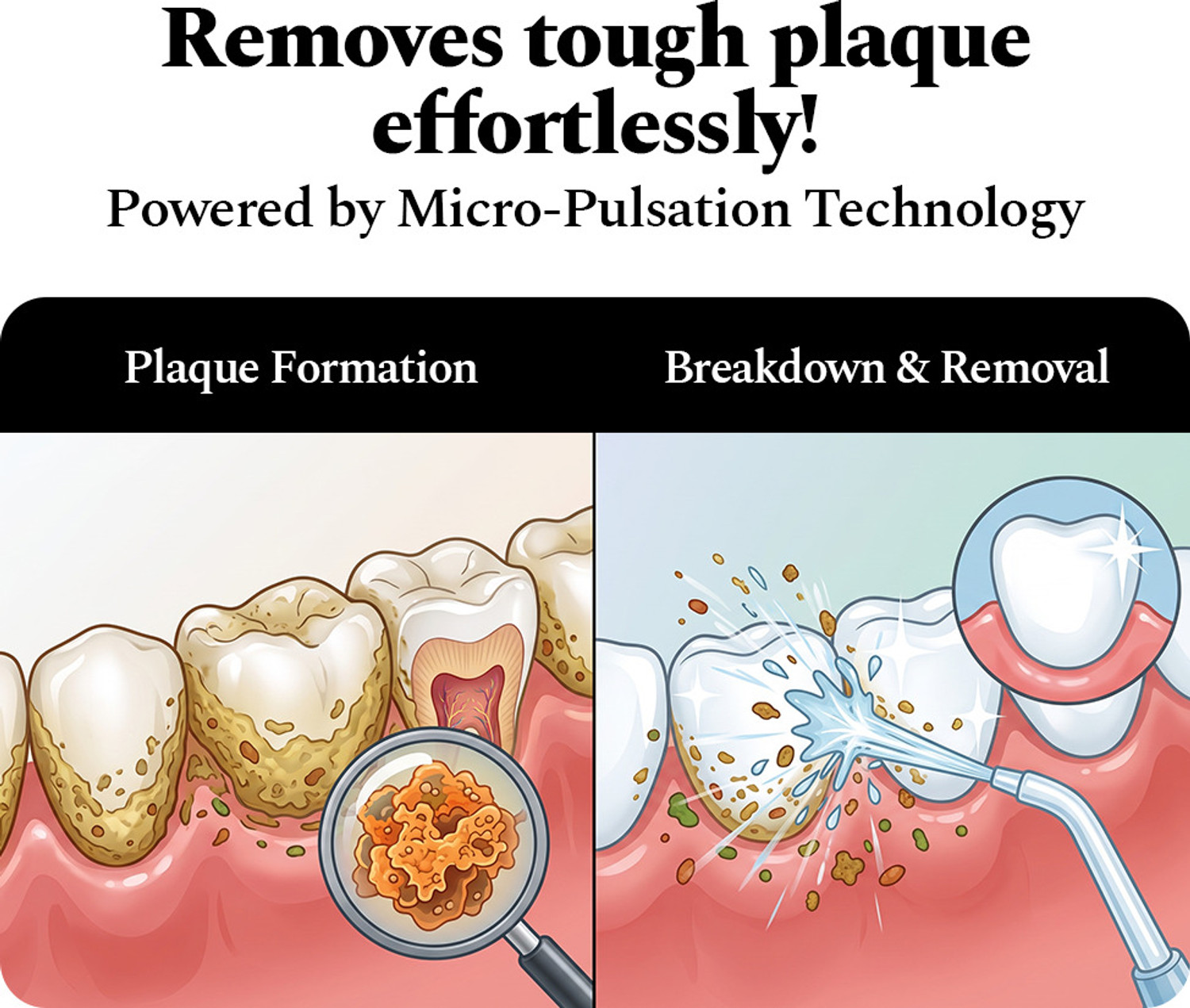 Image of Perfora Power Water Dental Flosser - 300 ml Water Flosser