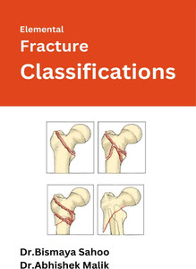 Elemental Fracture Classifications: Buy Elemental Fracture ...