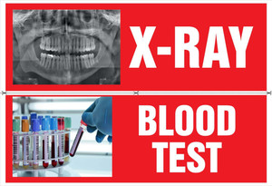 Poster Doctor Medical X Ray & Blood Test Sticker sl-9677 (Large Poster ...