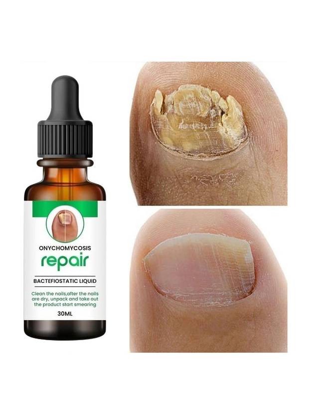 Estetica Nail Serum Boost Nail Strong & Repair Nails